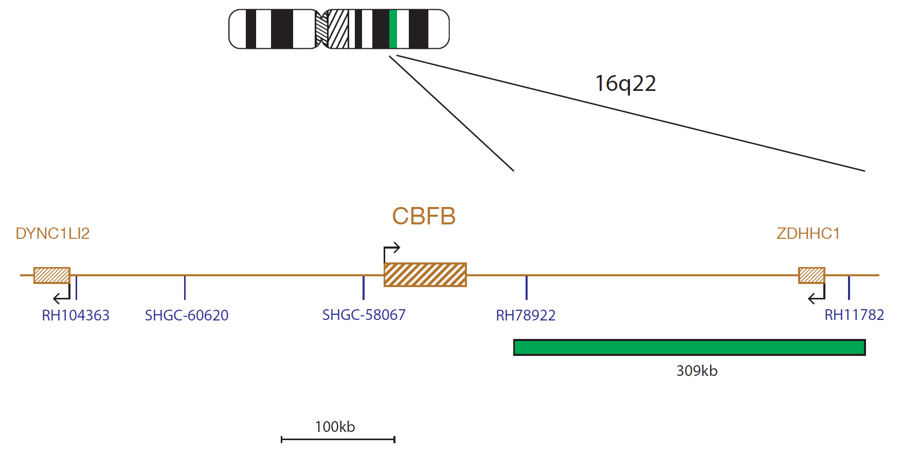 Fluorescence in situ hybridization (FISH) chromosome map showing a probe targeting the CBFB gene.