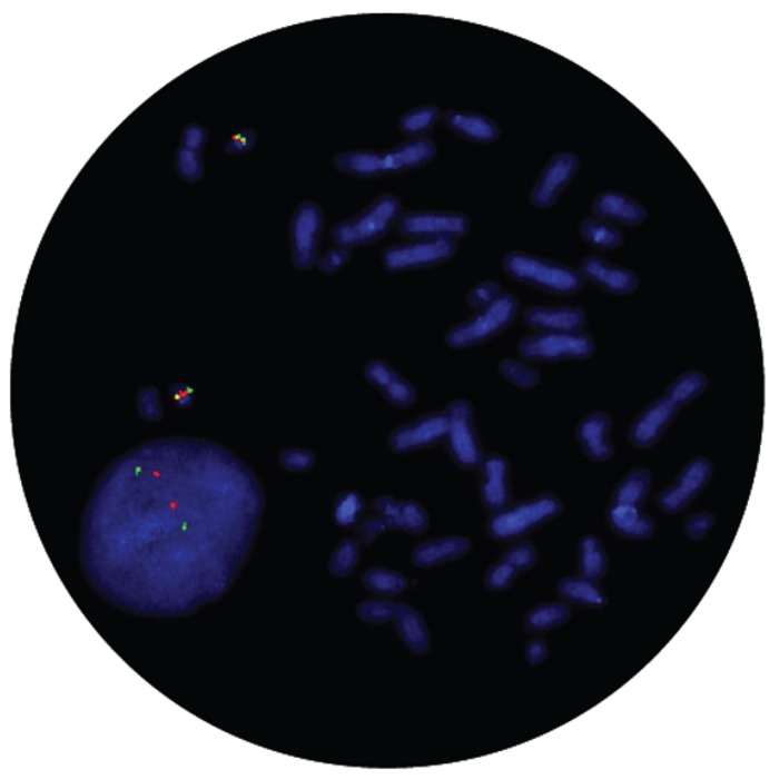 Fluorescence in situ hybridization (FISH) microscope image of the CytoCell IGL Breakapart probe.