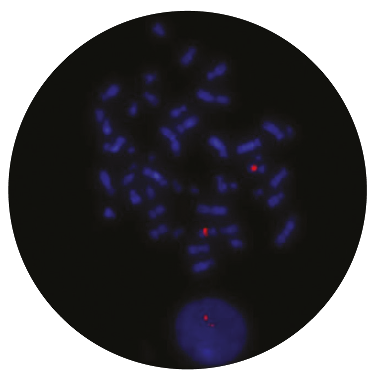 Fluorescence in situ hybridization (FISH) microscope image of the CytoCell MYEOV Plus probe.