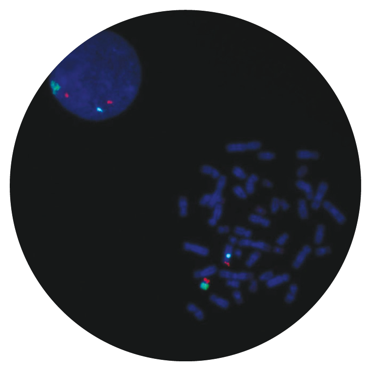 Fluorescence in situ hybridization (FISH) microscope image of the CytoCell SHOX probe.