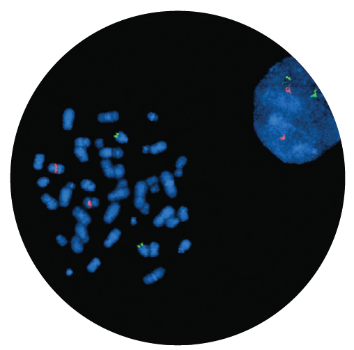 Fluorescence in situ hybridisation (FISH) microscope image of the CytoCell IGH/CCND1 Translocation, Dual Fusion probe.