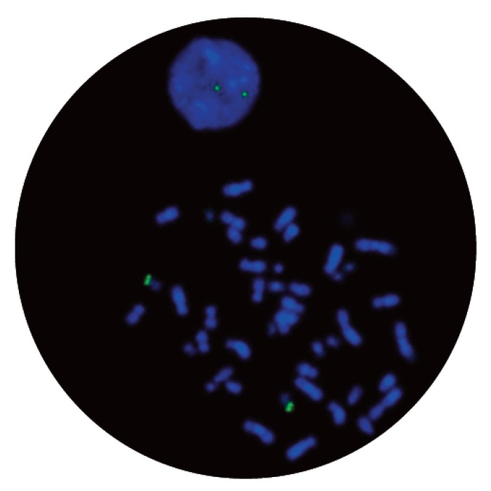 Fluorescence in situ hybridization (FISH) microscope image of the CytoCell P53 (TP53) Probe Green.