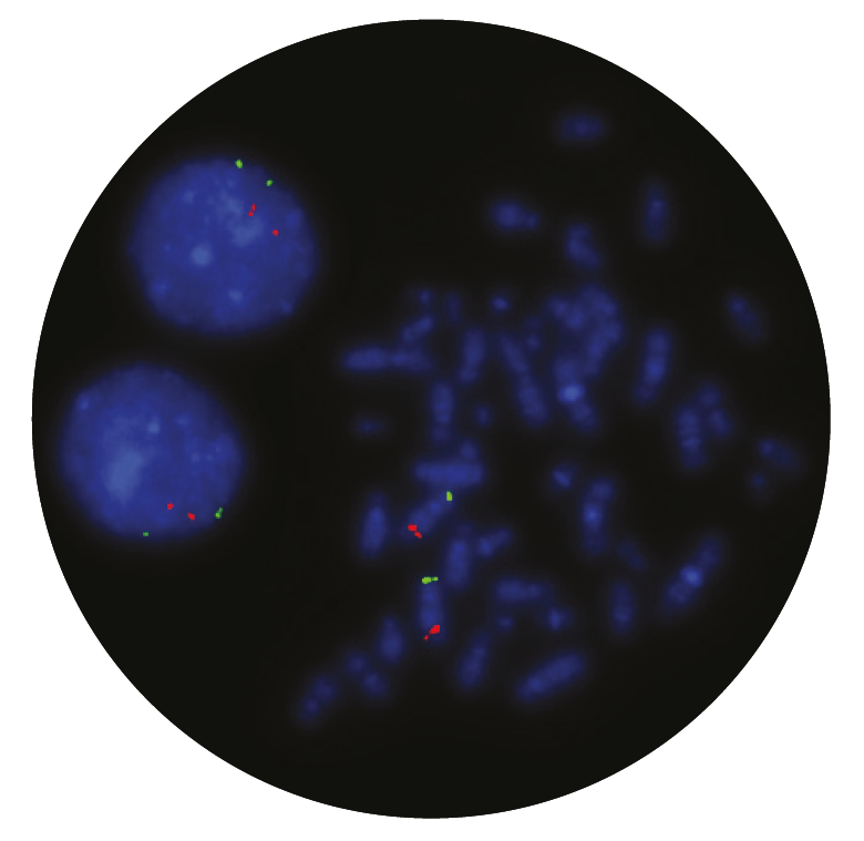 Fluorescence in situ hybridisation (FISH) microscope image of the CytoCell Del(5q) Deletion probe.
