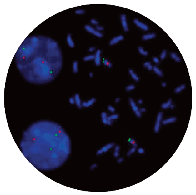 Fluorescence in situ hybridisation (FISH) microscope image of the CytoCell D13S25 Deletion probe.