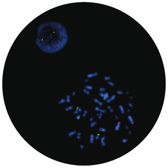Fluorescence in situ hybridization (FISH) microscope image of the CytoCell IGH/FGFR3 Translocation, Dual Fusion probe.