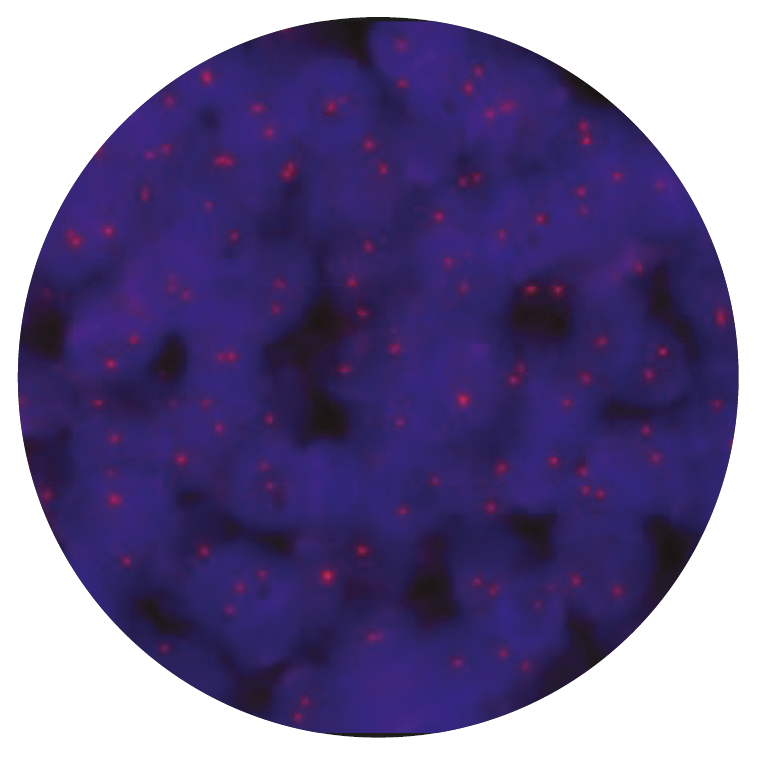 Fluorescence in situ hybridization (FISH) microscope image of the CytoCell FUS Proximal Probe Red.