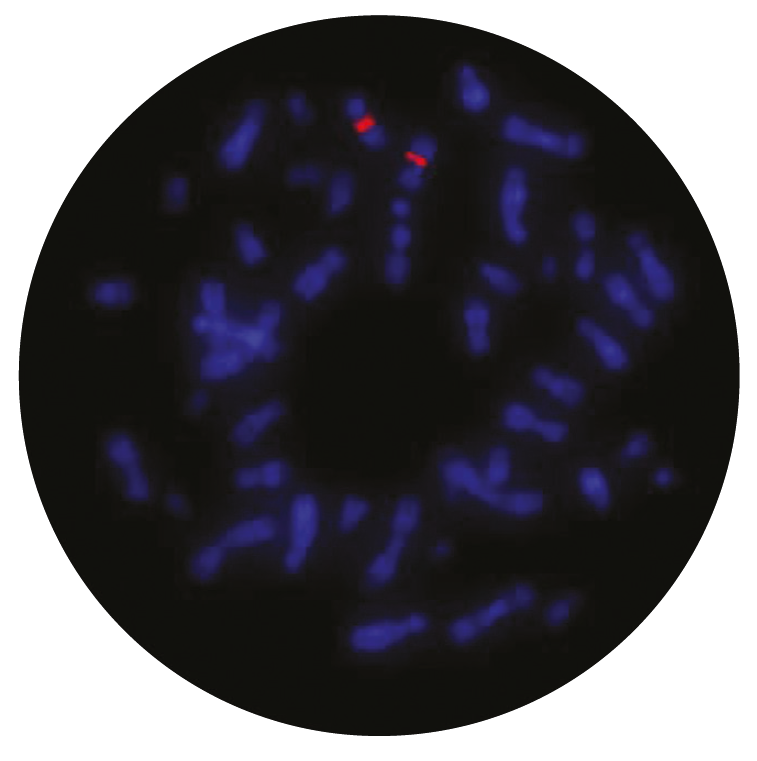 Fluorescence in situ hybridization (FISH) microscope image of the CytoCell CCND1 Plus probe.