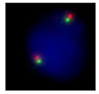 IGH Plus Breakapart (LPH 070) using 10ul of probe