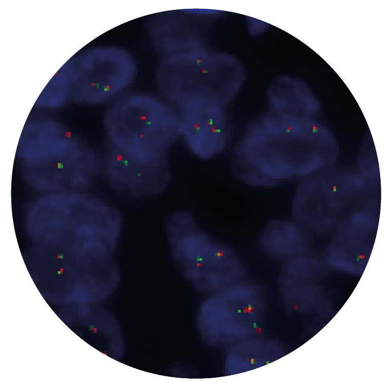 Fluorescence in situ hybridization (FISH) microscope image of the CytoCell EWSR1 Breakapart probe.