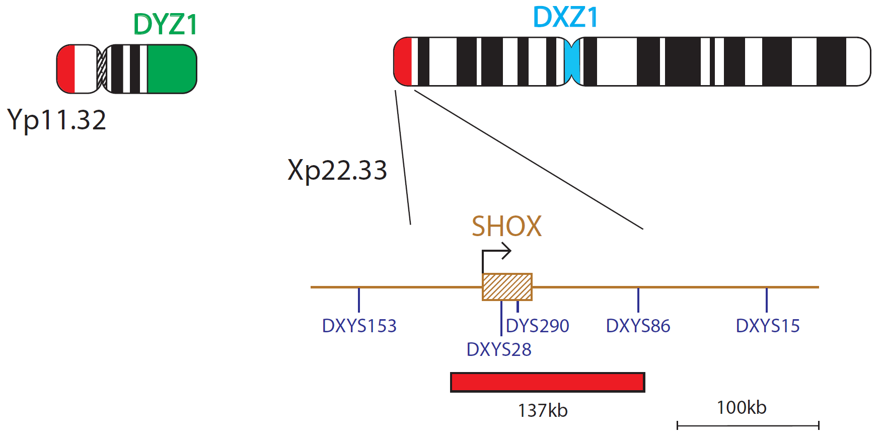 Fluorescence in situ hybridization (FISH) chromosome map showing probes targeting the SHOX gene.