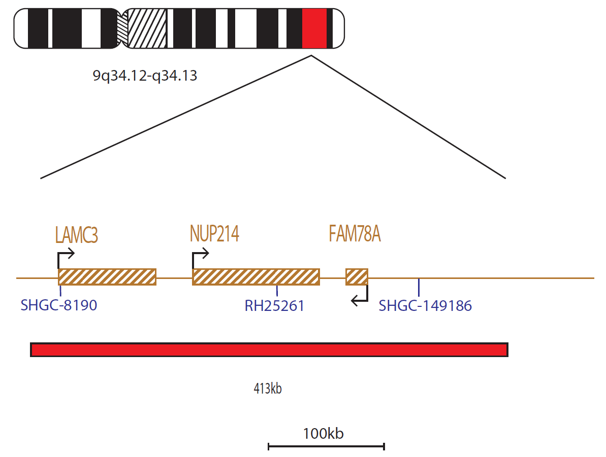 Fluorescence in situ hybridization (FISH) chromosome map showing a probe targeting the NUP214 gene.