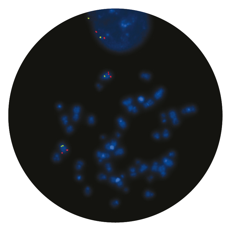 Fluorescence in situ hybridisation (FISH) microscope image of the CytoCell MYB Deletion probe.