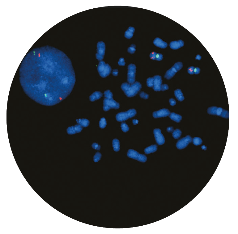 Fluorescence in situ hybridisation (FISH) microscope image of the CytoCell ATM Deletion probe.
