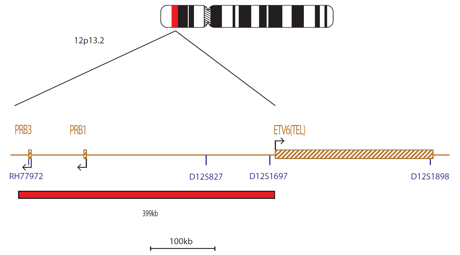 Fluorescence in situ hybridization (FISH) chromosome map showing a probe distal to the ETV6 (TEL) gene.
