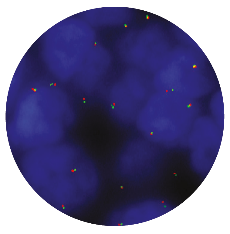 Fluorescence in situ hybridisation (FISH) microscope image of the CytoCell MALT1 Breakapart probe.