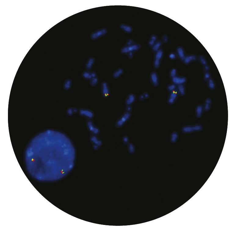 Fluorescence in situ hybridisation (FISH) microscope image of the CytoCell PDGFRB Breakapart probe.