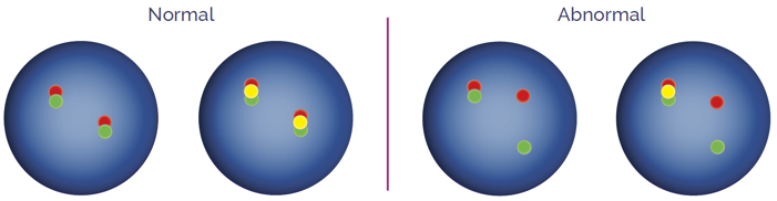 Dual-colour breakapart probes