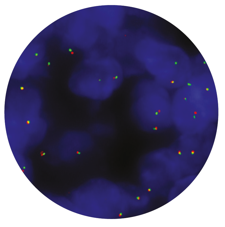Fluorescence in situ hybridization (FISH) microscope image of the CytoCell CHOP (DDIT3) Breakapart probe.