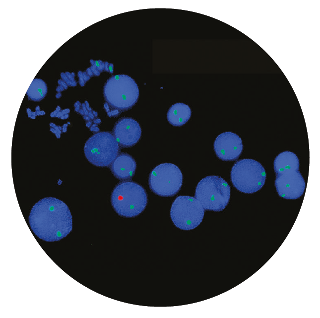 Fluorescence in situ hybridisation (FISH) microscope image of the CytoCell Dual Labelled Satellite probe sets.