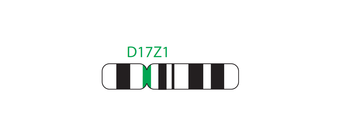 Fluorescence in situ hybridization (FISH) chromosome map showing a probe targeting the region 17cen (D17Z1).