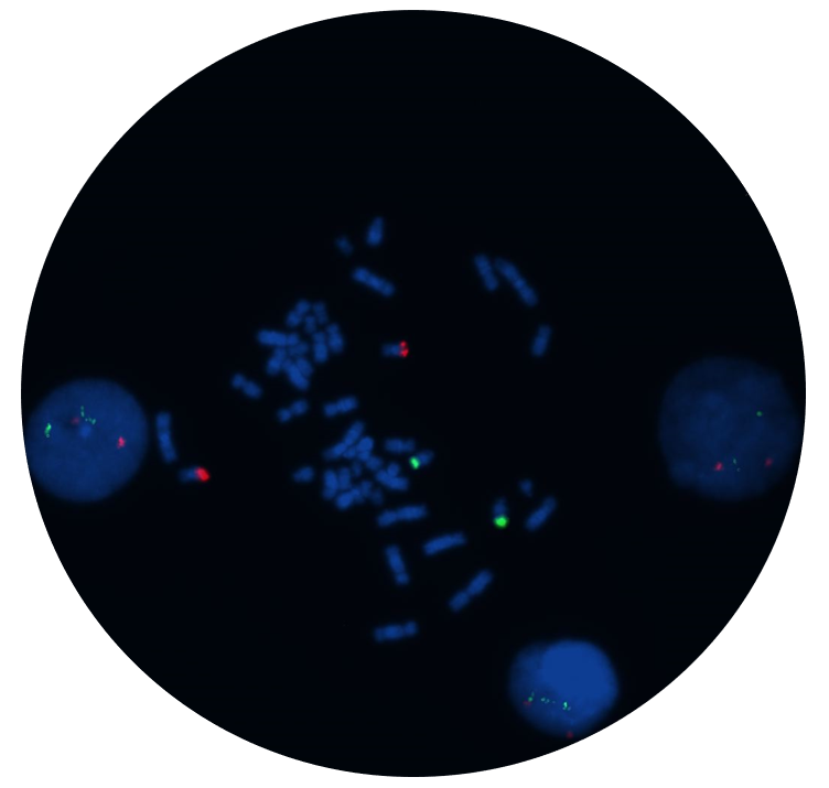 Fluorescence in situ hybridisation (FISH) microscope image of the CytoCell IGH/MAF v2 Translocation, Dual Fusion probe.