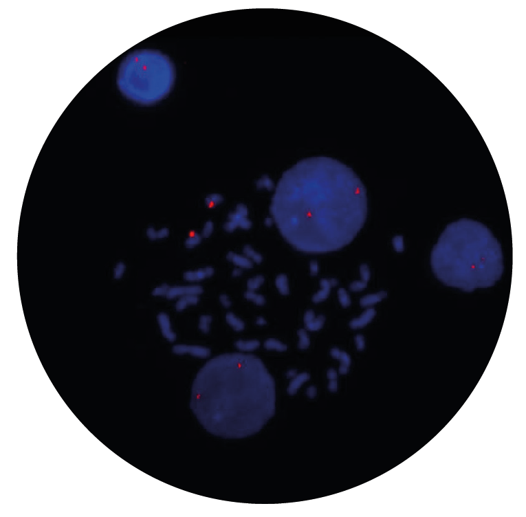 Fluorescence in situ hybridization (FISH) microscope image of the CytoCell ETV6 Distal Probe Red.