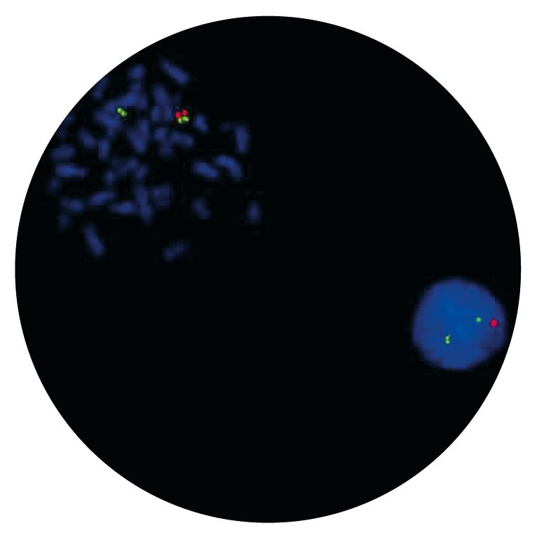Fluorescence in situ hybridization (FISH) microscope image of the CytoCell DiGeorge/VCFS TUPLE1 Region and 22q13.3 probe.