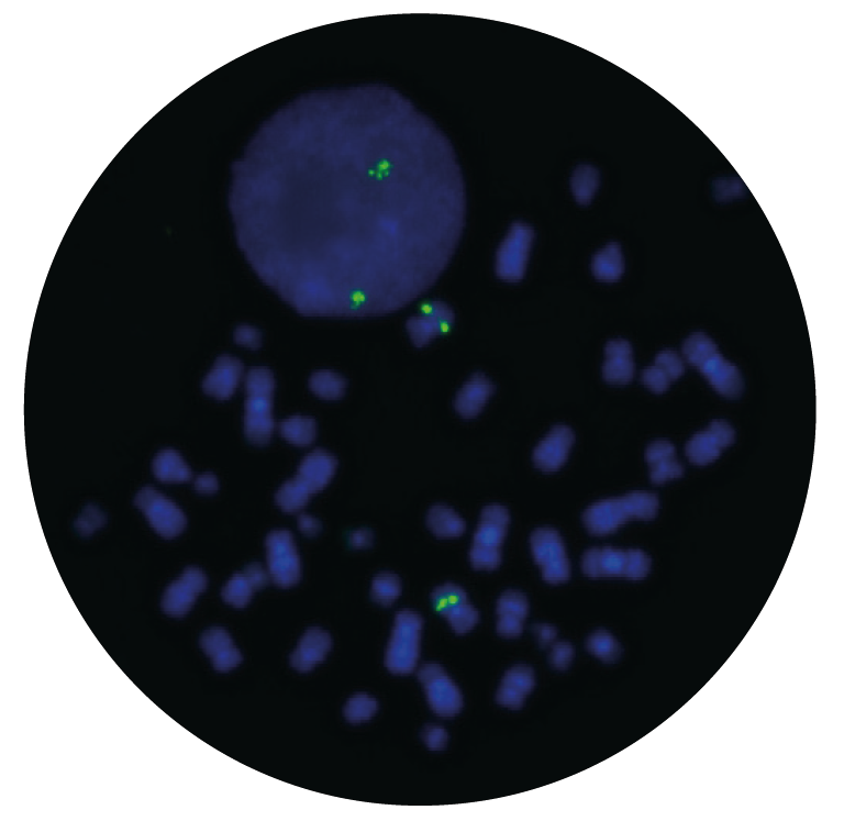 Fluorescence in situ hybridization (FISH) microscope image of the CytoCell CUX1 (7q22) Probe Green.