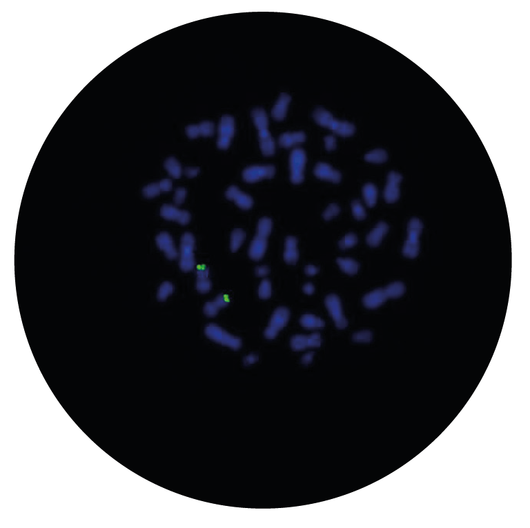 Fluorescence in situ hybridization (FISH) microscope image of the CytoCell NUP98 Distal Probe Green.