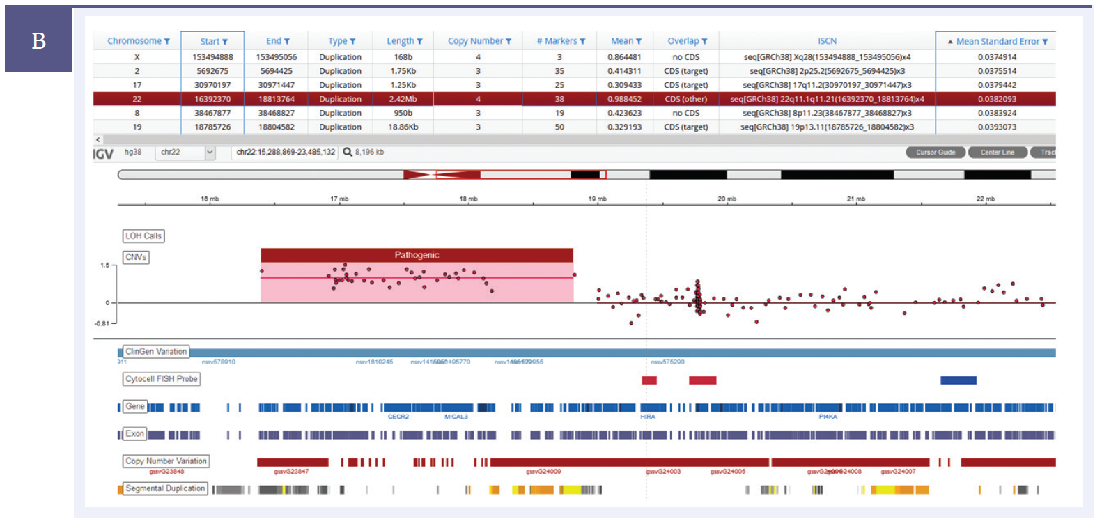 Next generation sequencing (NGS) software data showing a 2.42Mb duplication on chromosome 22.