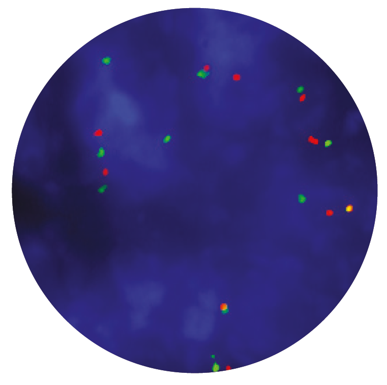 Fluorescence in situ hybridisation (FISH) microscope image of the CytoCell MDM2 Amplification probe.