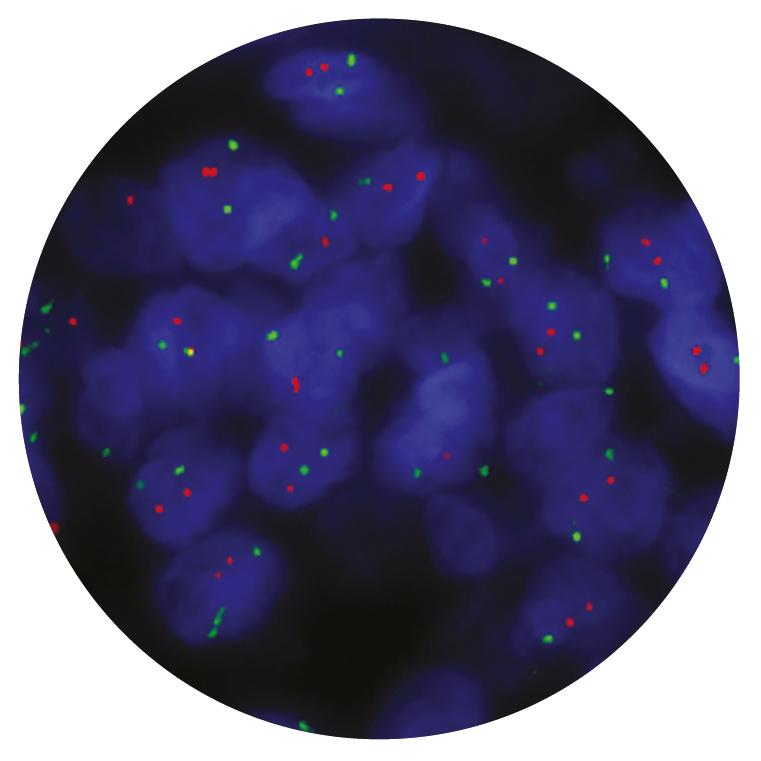 Fluorescence in situ hybridization (FISH) microscope image of the CytoCell P16 (CDKN2A) Deletion probe.