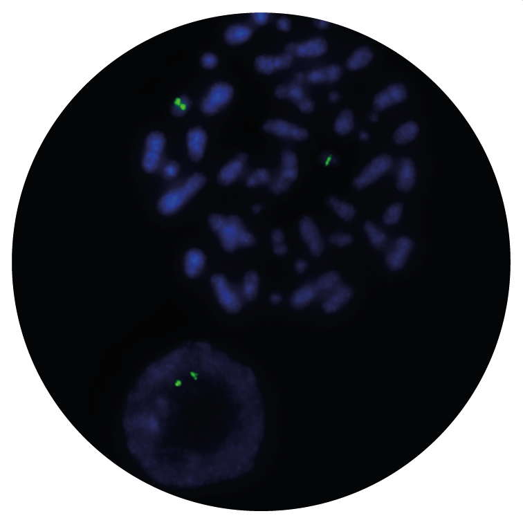 Fluorescence in situ hybridization (FISH) microscope image of the CytoCell RARα (RARA) Distal probe.