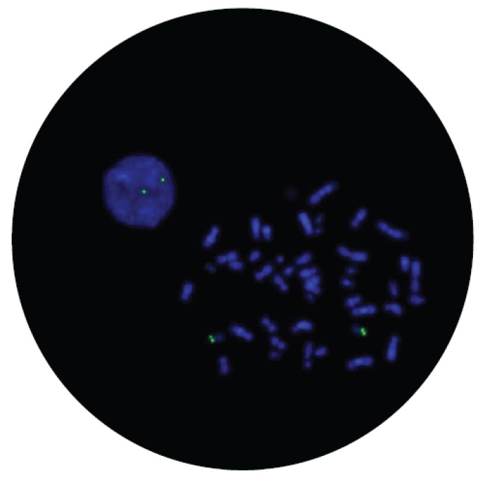 Fluorescence in situ hybridization (FISH) microscope image of the CytoCell P53 (TP53) Probe Green.