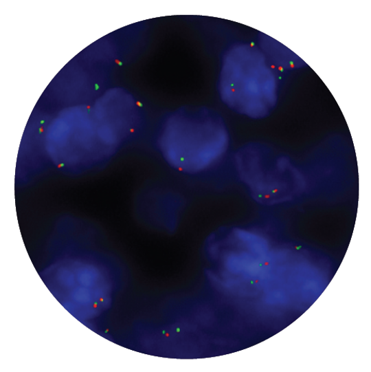 Fluorescence in situ hybridisation (FISH) microscope image of the CytoCell PAX3 Breakapart probe.