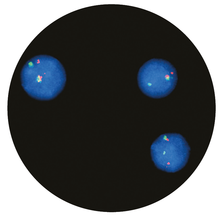 Fluorescence in situ hybridisation (FISH) microscope image of the CytoCell IGH Breakapart probe.