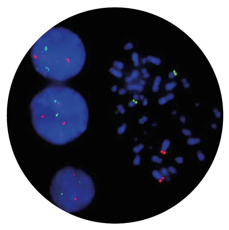 Fluorescence in situ hybridisation (FISH) microscope image of the CytoCell IGH/FGFR3 Plus Translocation, Dual Fusion probe.