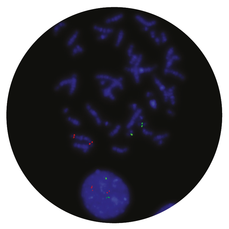 Fluorescence in situ hybridisation (FISH) microscope image of the CytoCell PML/RARA Translocation, Dual Fusion probe.