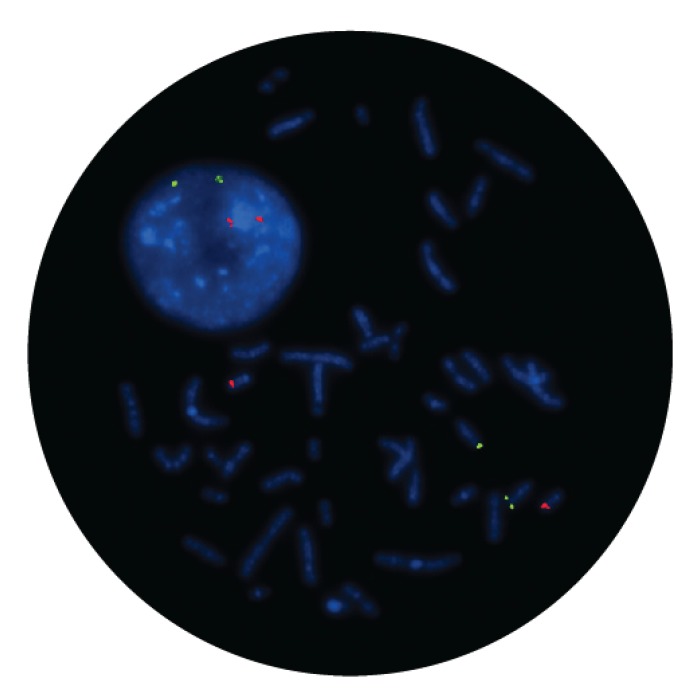 Fluorescence in situ hybridization (FISH) microscope image of the CytoCell IGH/BCL2 Translocation, Dual Fusion probe.