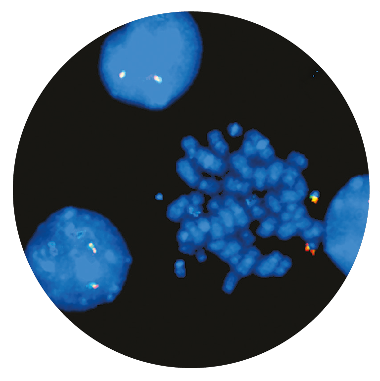 Fluorescence in situ hybridization (FISH) microscope image of the CytoCell AML1 (RUNX1) Breakapart probe.