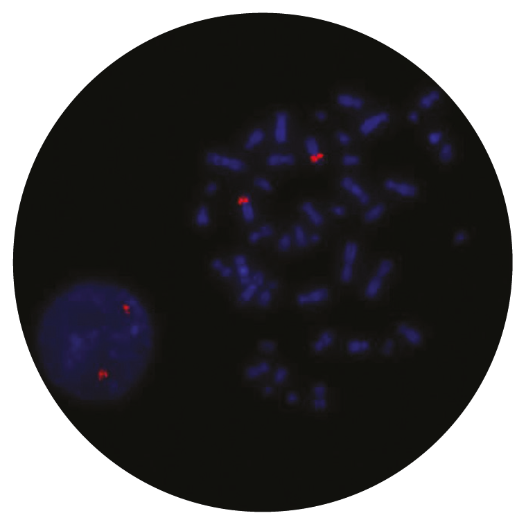 Fluorescence in situ hybridization (FISH) microscope image of the CytoCell CCND3 Plus probe.