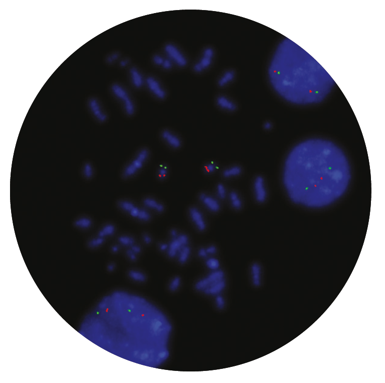Fluorescence in situ hybridisation (FISH) microscope image of the CytoCell CBFB/MYH11 Translocation, Dual Fusion probe.
