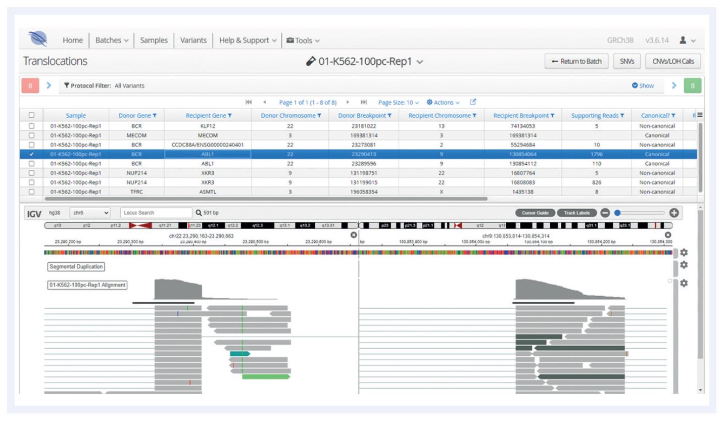 NGS software data showing Interpret