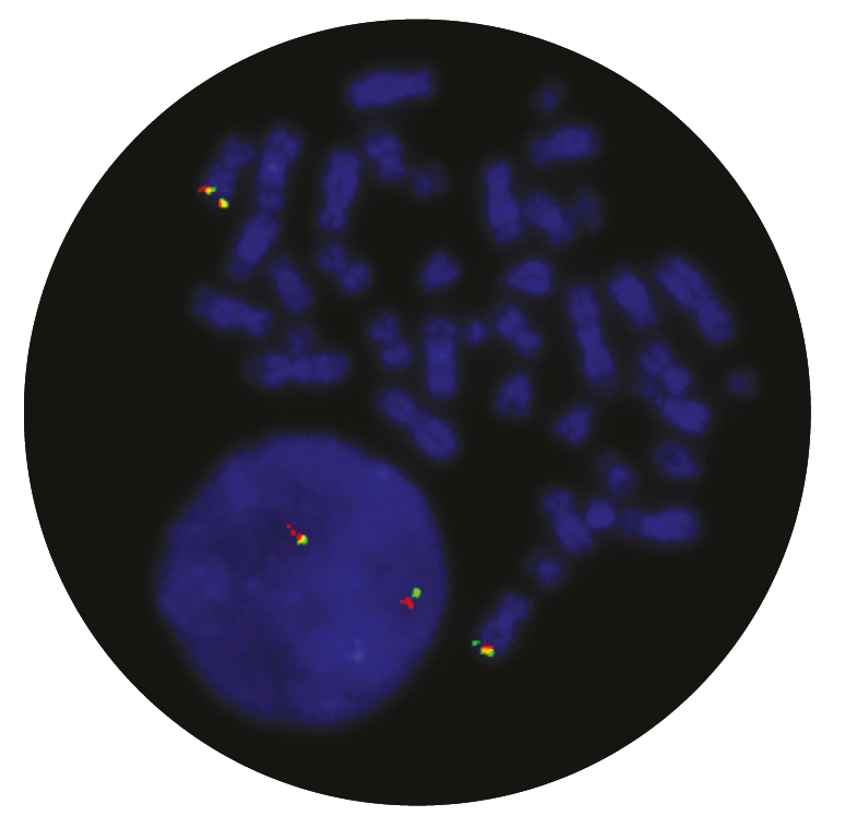 Fluorescence in situ hybridisation (FISH) microscope image of the CytoCell TCRB (TRB) Breakapart probe.
