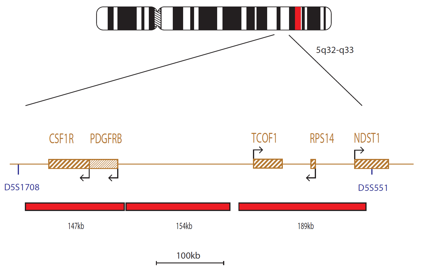 Fluorescence in situ hybridization (FISH) chromosome map showing a probes targeting the CSF1R and RPS14 genes.