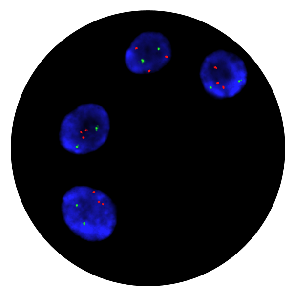 Fluorescence in situ hybridisation (FISH) microscope image of the CytoCell Prenatal X, Y, 13, 18 and 21 probe.
