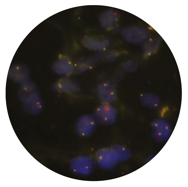 Fluorescence in situ hybridisation (FISH) microscope image of the CytoCell RET Breakapart probe.