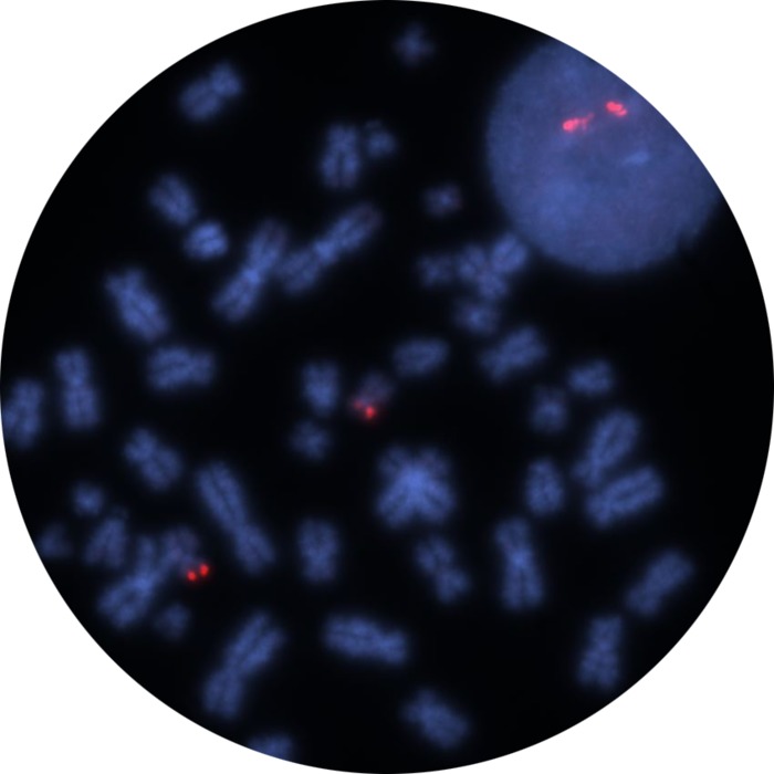Fluorescence in situ hybridization (FISH) microscope image of the CytoCell P53 (TP53) Probe Red.