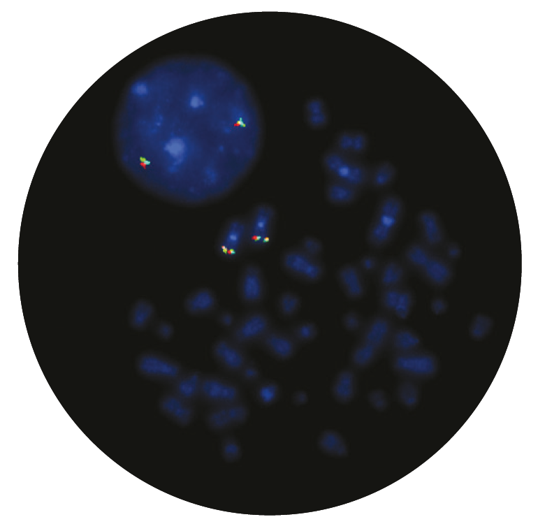 Fluorescence in situ hybridisation (FISH) microscope image of the CytoCell EVI1 (MECOM) Breakapart probe.
