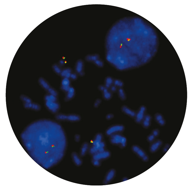 Fluorescence in situ hybridization (FISH) microscope image of the CytoCell MLL (KMT2A) Breakapart probe.